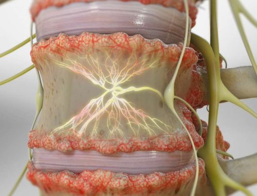 Lasting Relief from Chronic Low Back Pain: The Benefits of Basivertebral Nerve Ablation